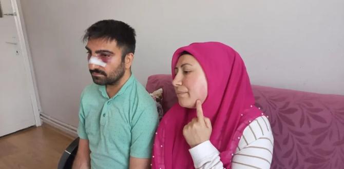 Engelli Komşusunun Burnunu Kırdı, Kaynayan Semaveri Üstüne Döktü: Amasya’da Şiddet Olayı